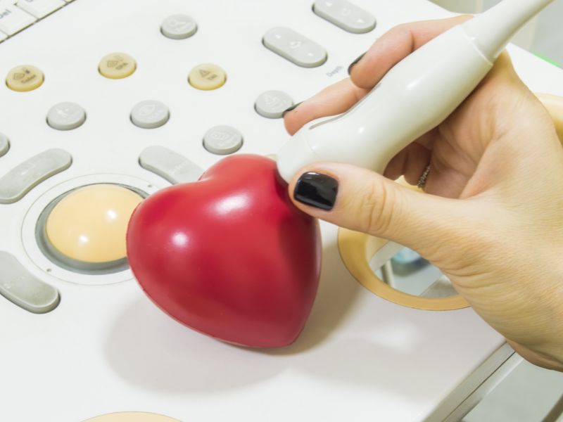 como é feito o ecocardiograma - etapas