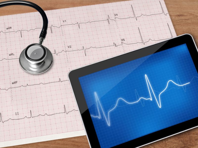 como é feito eletrocardiograma