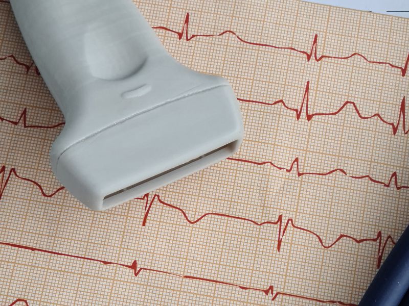ecocardiograma preço popular fortaleza - dicas