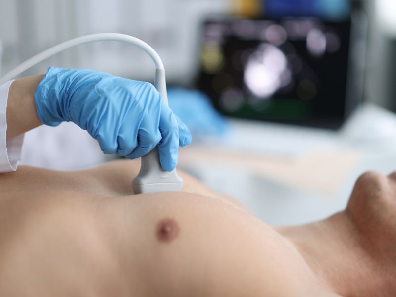 onde fazer ecocardiograma em Fortaleza - o que observar