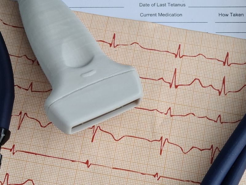 para que serve o ecocardiograma - quando fazer