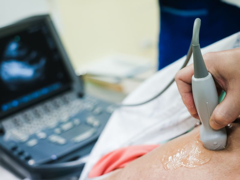 qual o preparo para fazer ecocardiograma com doppler