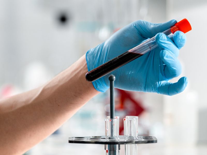 o que é lipoproteína a - definição