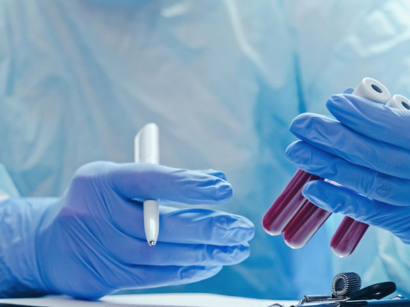 o que é lipoproteína a - conclusão