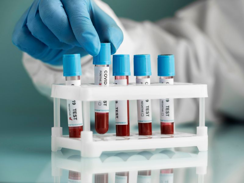 para que serve o exame lipoproteína a - situações