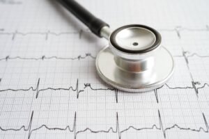 eletrocardiograma para check up em fortaleza